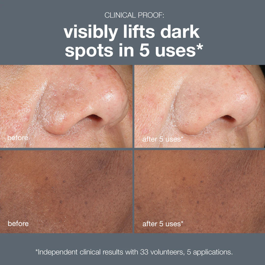 DERMALOGICA - POWERBRIGHT DARKSPOT PEEL