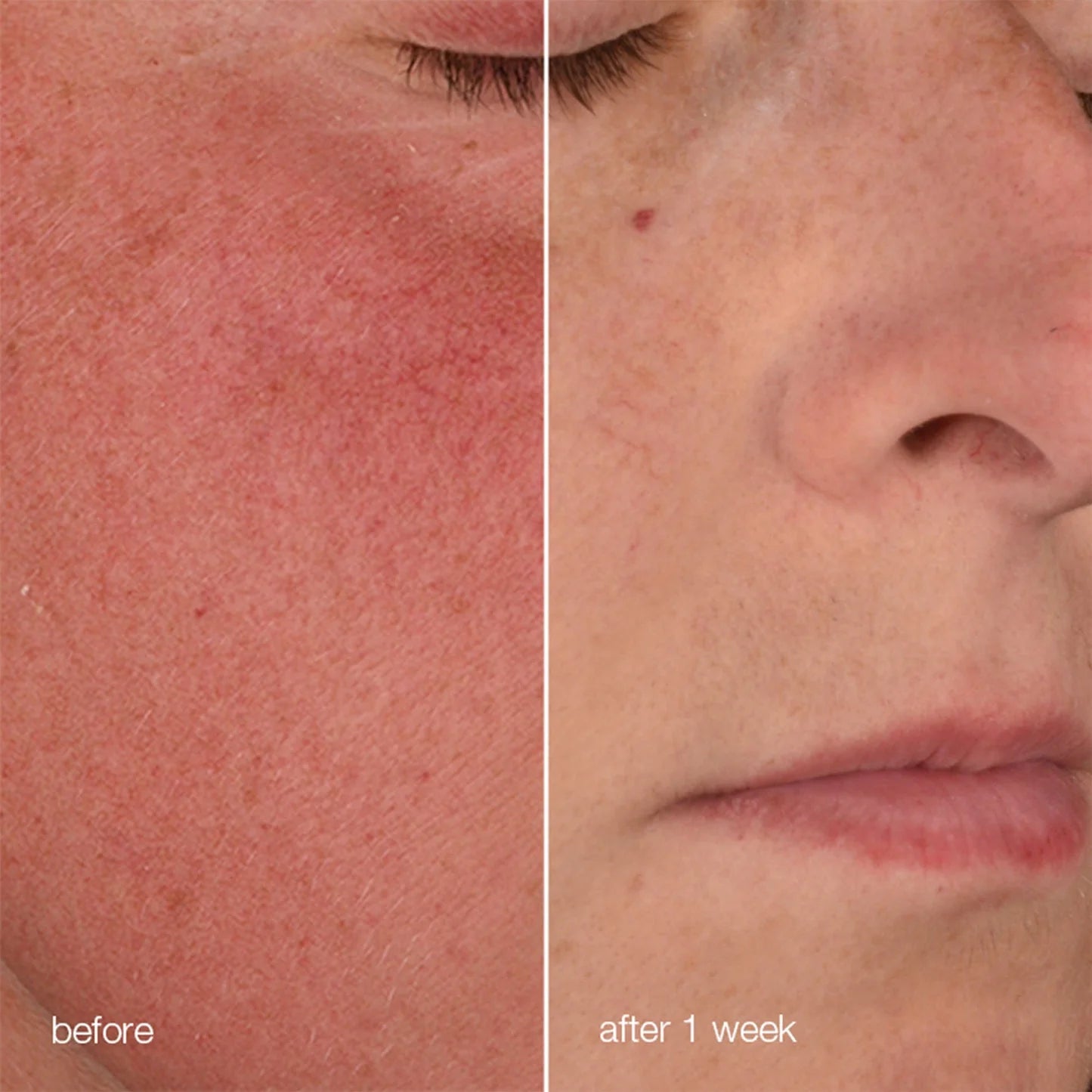 DERMALOGICA - STABILIZING REPAIR CREAM