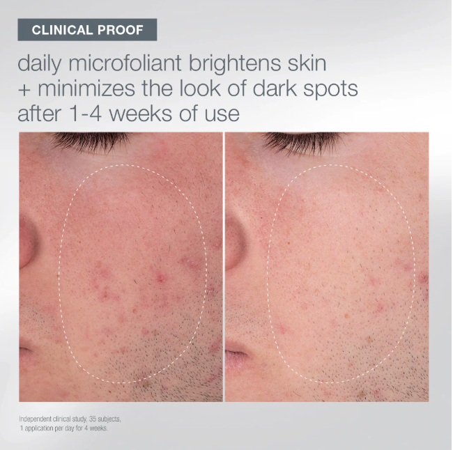 DERMALOGICA - FIRST SNOW OF THE SEASON