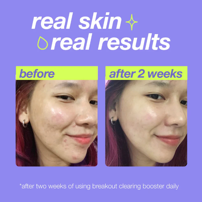 DERMALOGICA BREAKOUT CLEARING BOOSTER