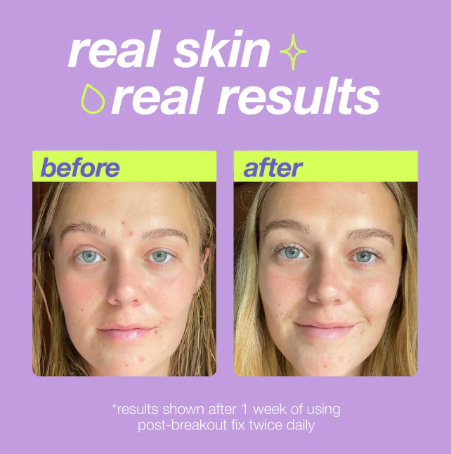 DERMALOGICA clear start - post-spot fix 15 ML