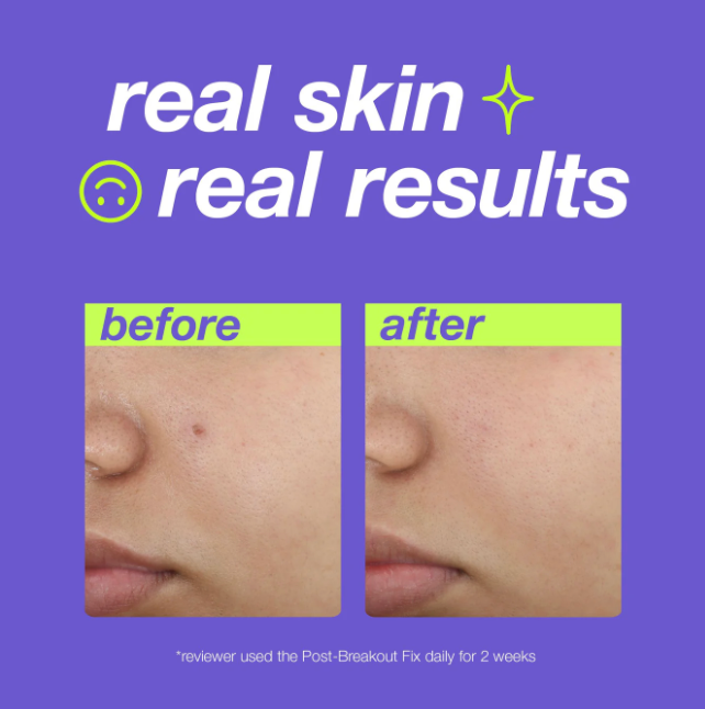 DERMALOGICA clear start - post-spot fix 15 ML