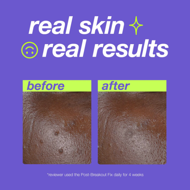 DERMALOGICA clear start - post-spot fix 15 ML
